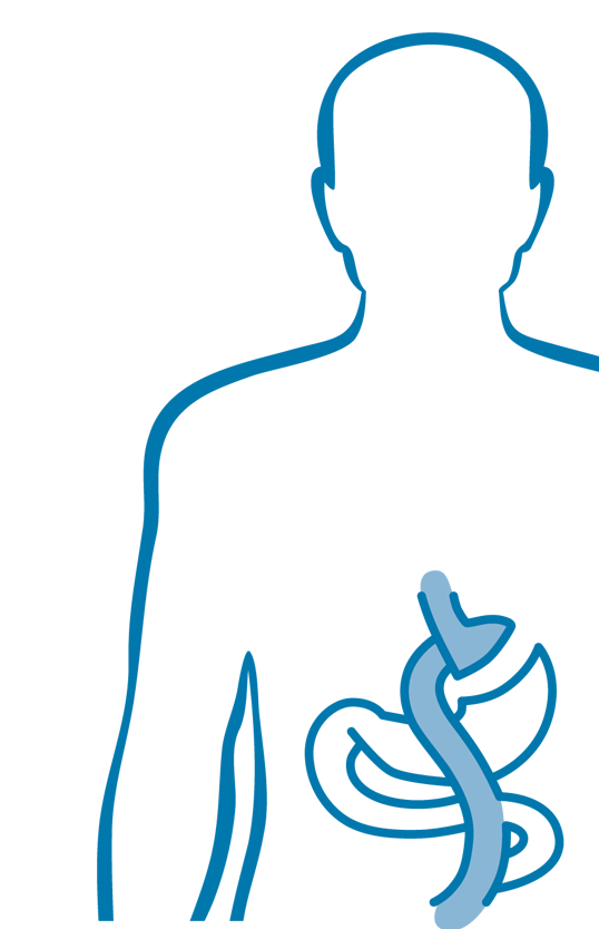 Adipositaschirurgie